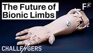 3D printed, mind-controlled prosthetics are here | Challengers by Freethink