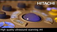 #4 High quality ultrasound scanning in Turkey : Demo -Hitachi Medical Systems - Hitachi