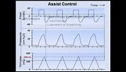 Ventilator Modes (Mechanical Ventilation - Lecture 7)