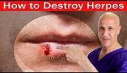 How to Destroy HERPES | Dr. Mandell