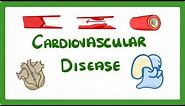 GCSE Biology - Why Do We Get Heart Disease and How to Treat It? - Cardiovascular Disease (CVD) #47
