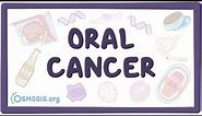 Oral Cancer - causes, symptoms, diagnosis, treatment, pathology