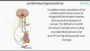 carotid sinus hypersensitivity