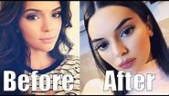 Kendall Jenner TOTALLY Just Got Plastic Surgery! She Looks Completely Different!