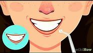 How to Straighten Your Teeth Without Braces