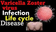 Varicella zoster virus pathogenesis | chickenpox virus