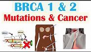 BRCA1 and BRCA2 Mutations & Cancer (Types of Cancer, and Who’s Most At Risk)