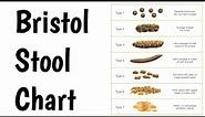 Bristol Stool Chart | Bristol Stool Scale | Meyers Scale |