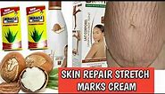 How To Mix Effective Stretch Marks Removal Cream Using Bravia Lotion & Shea Butter.|BEAUTY BY BETTY|