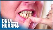 My Husband Has Never Seen My Teeth | Extreme Smile Makeover | Only Human