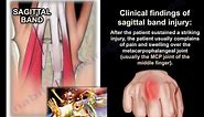 Sagittal Band Injury - Everything You Need To Know - Dr. Nabil Ebraheim