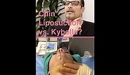 Double Chin Liposuction vs. Kybella San Diego