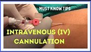 INTRAVENOUS (I.V) CANNULATION (in 5 mins)| How to insert