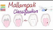 Mallampati Score (Classification) for Airway Management