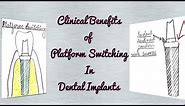 Clinical Benefits of Platform Switching in Dental Implants