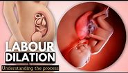 Labor Dilation: The Most Important Labor & Delivery Factor
