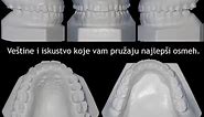➡️ Ortodontski gipsani modeli -... - Ortodoncija - dr Popov