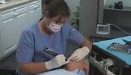 KaVo Diagnodent Pen: Laser Fluorescence Caries Detection