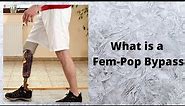 What is a Fem Pop Bypass