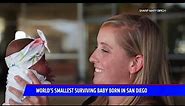 World`s Smallest Baby Born In San Diego