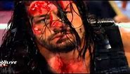 Triple H Broke Roman Reigns Nose Highlights Full Match !! Brutal Bloody Fight 22/2/16