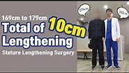 Growing 10cm Taller by Stature Lengthening Surgery