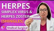 Herpes Simplex Virus and Herpes Zoster Shingles: Integumentary System - Med-Surg | @LevelUpRN