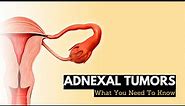 Adnexal Tumors: What You Need To Know