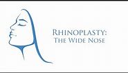 What is a Wide Nose Rhinoplasty? | Dr. Anthony Corrado
