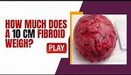 How Much does a 10 CM Fibroid Weigh? [LEARN MORE]