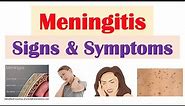 Meningitis Signs and Symptoms (& Why They Occur)