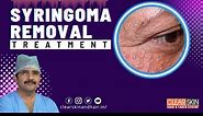 How To Treat Syringomas || Syringomas Removal Treatment | Clear Skin Hair and Laser Centre #kurnool