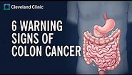 6 Warning Signs of Colon Cancer
