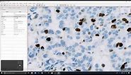 1 - Introduction to QuPath for IHC analysis