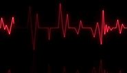Heart Rate Monitors Electrocardiogram EKG ECG Heart Beat Line Template Cardiogram Monitor