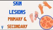 SKIN LESIONS | Primary & Secondary