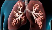 COPD I Nucleus Health