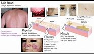 Understanding Rash in 3 minutes. Skin Rash types and causes.