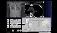 CT Coronary Angio Full Work Process (SIEMENS) in syngo acquisition workplace