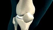 Knee Joint - Meniscus - 3D Medical Animation || ABP ©
