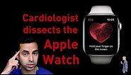 Cardiologist’s scientific analysis of the Apple Watch