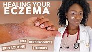 How to Treat ECZEMA-Atopic Dermatitis: Black Dark Skin, Dry Flaky Skincare Routine Hyperpigmentation