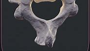 Second cervical vertebra or axis (C2)