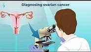 Diagnosing Ovarian Cancer