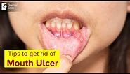 Mouth Ulcer| Mouth Sores: Symptoms, Treatment & Prevention Methods-Dr.Lahari A.S.R | Doctors' Circle