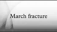 March fracture