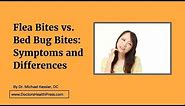 Flea Bites vs. Bed Bug Bites: Symptoms and Differences | Doctors Health Press