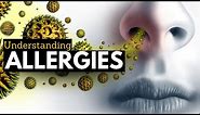 What is Allergy? Causes, Signs and Symptoms, Diagnosis and Treatment.