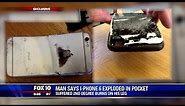 Phoenix man claims iPhone 6 exploded in his pocket