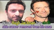 Actor Hugh Jackman has sixth skin cancer removed from his nose
